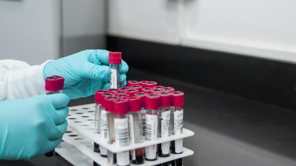 Consiliul Județean Dolj alocă 2 milioane de lei pentru un laborator de testare a consumului de droguri | Știri Craiova