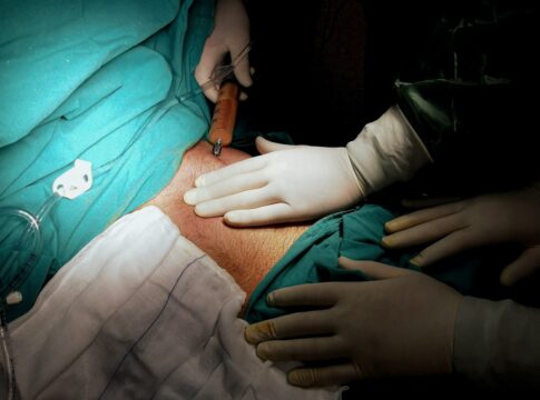 Sunt „doctor”, vând și cumpăr organe umane. Foto: Pexels/Mehmet Turgut-Kirkgoz