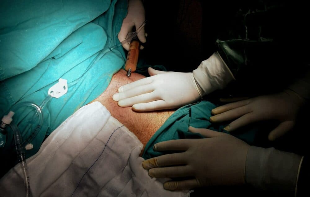Sunt „doctor”, vând și cumpăr organe umane. Foto: Pexels/Mehmet Turgut-Kirkgoz