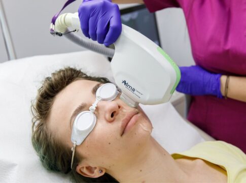 Terapii laser care tratează multe dintre afecţiunile dermatologice şi estetice vara
