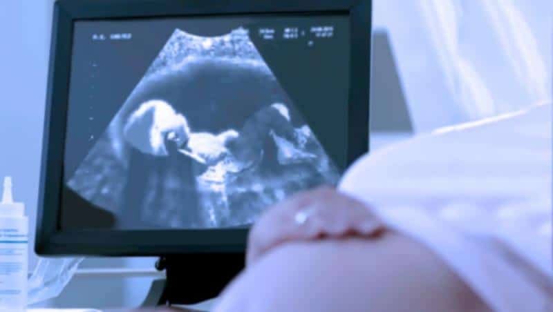 Cazul femeii gravide operate de hernie - medicii spun că o ecografie nu ar fi oferit informații suplimentare relevante 