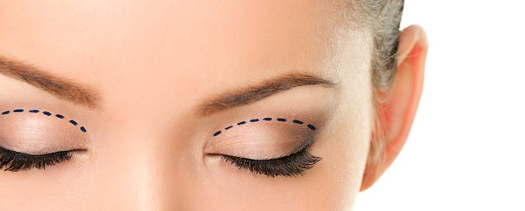 Blefaroplastia cu Dr. Diana Gheorghiță: O viziune modernă asupra frumuseții și tinereții